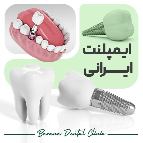 ایمپلنت مقایسه ایمپلنت ایرانی و کره ای