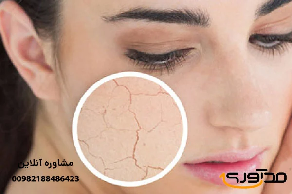 راهنمای انتخاب شماره رنگ رژ لب مایع کالباسی